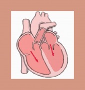 heart enlarged cr cutout image healthtips images